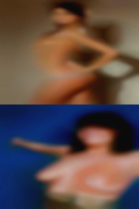 Dura females tear patient.